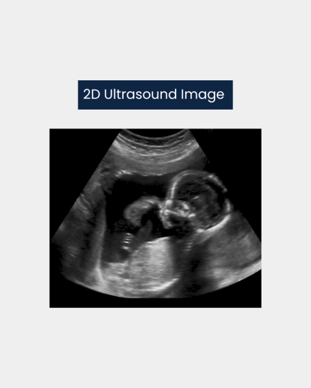 2D Ultrasound Machine Image|3D ultrasound machines|Differences in 3D ultrasound machines