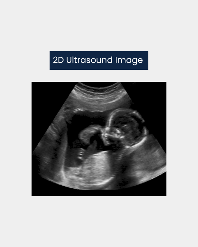 2D Ultrasound Machine Image|3D ultrasound machines|Differences in 3D ultrasound machines